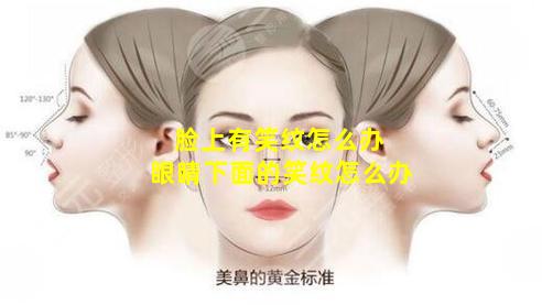 脸上有笑纹怎么办 眼睛下面的笑纹怎么办